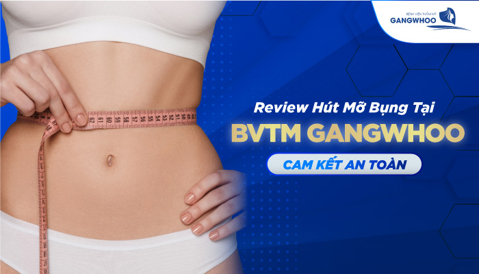 Review hút mỡ bụng tại BVTM Gangwhoo