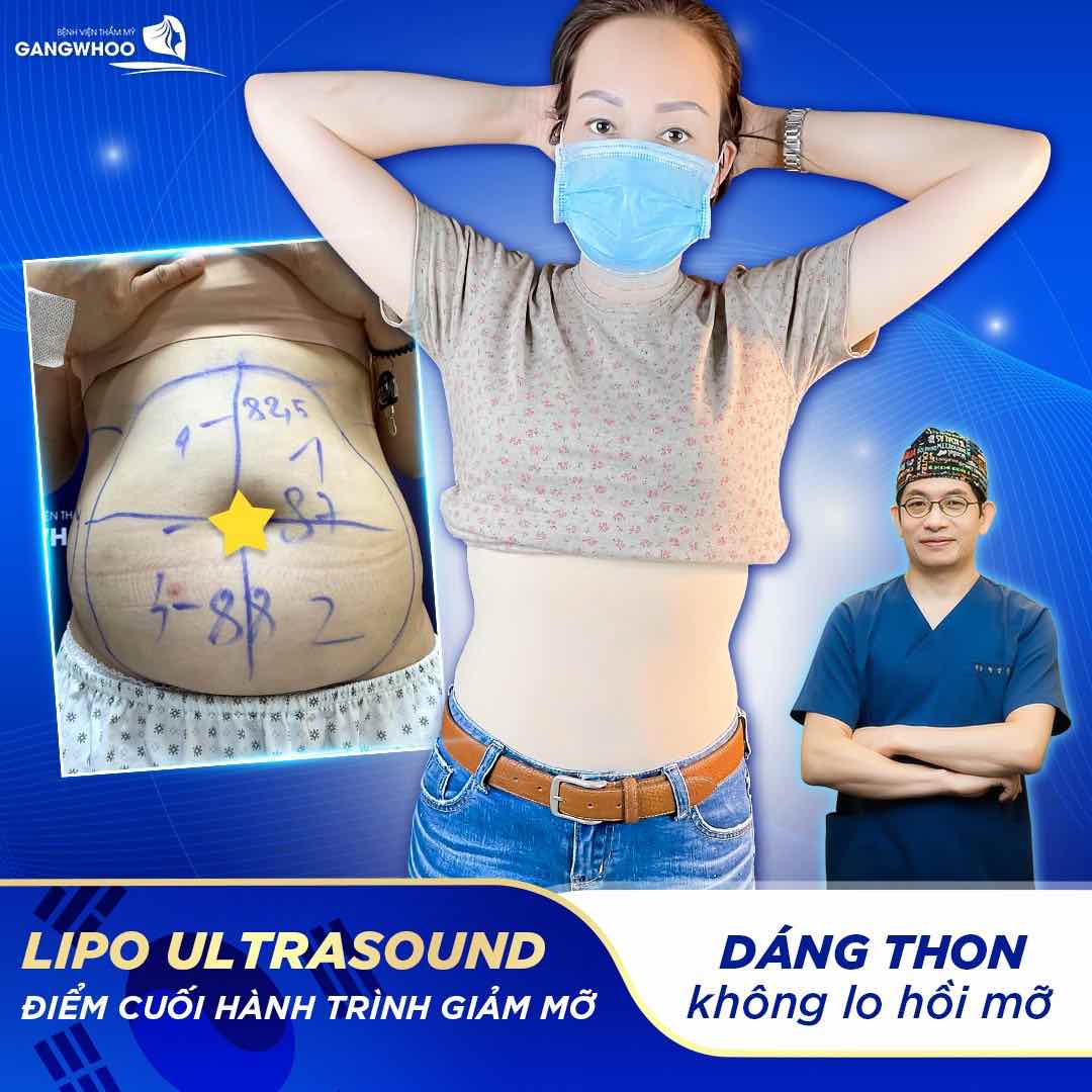 Lipo Ultrasound là công nghệ hút mỡ mới được chuyển giao trực tiếp từ Hàn Quốc