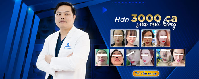 Bác sĩ Phùng Mạnh Cường - Chuyên gia tái phẫu thuật sửa mũi hỏng